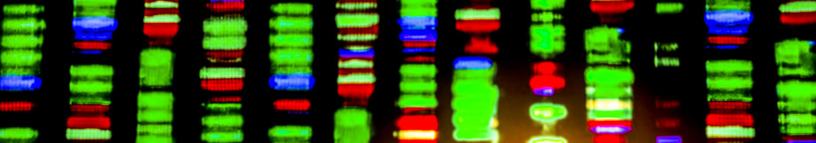 Columns of short horizontal bands of varying colours. 